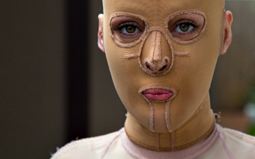The once almost burned alive Australian woman finally took off her mask The once almost burned alive Australian woman finally took off her mask