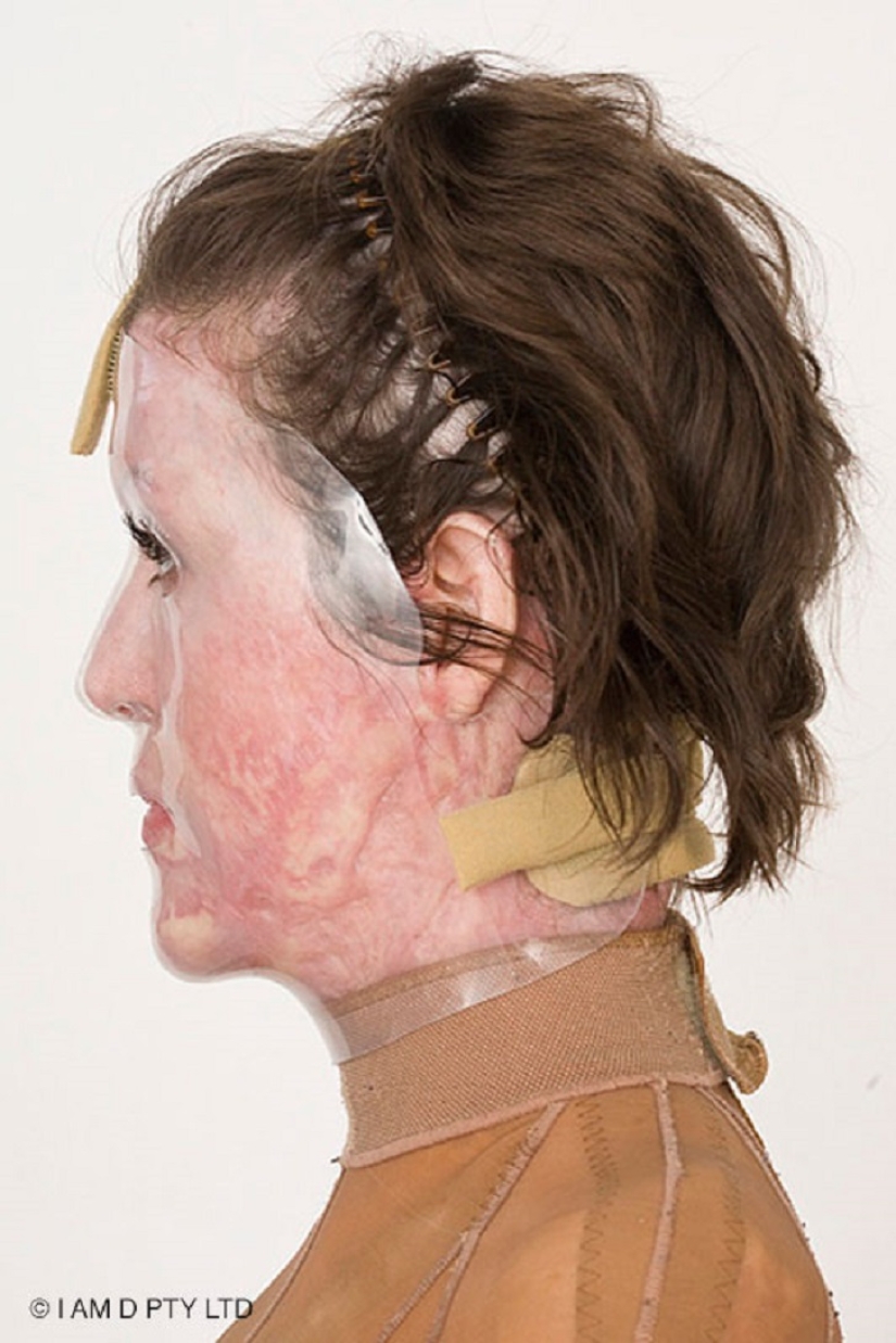 The once almost burned alive Australian woman finally took off her mask The once almost burned alive Australian woman finally took off her mask