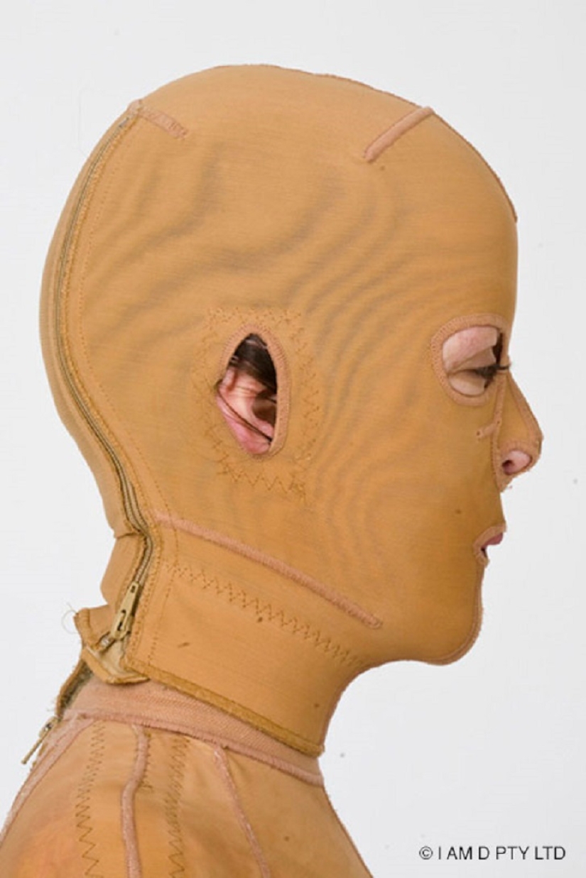 The once almost burned alive Australian woman finally took off her mask The once almost burned alive Australian woman finally took off her mask