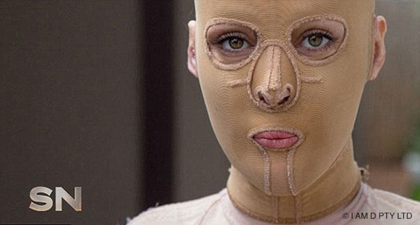 The once almost burned alive Australian woman finally took off her mask The once almost burned alive Australian woman finally took off her mask