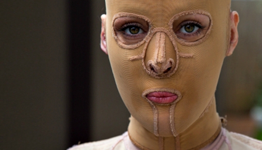 The once almost burned alive Australian woman finally took off her mask The once almost burned alive Australian woman finally took off her mask