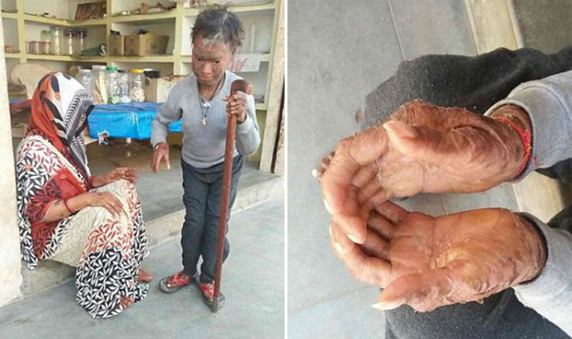 The snake girl sheds her skin every six weeks