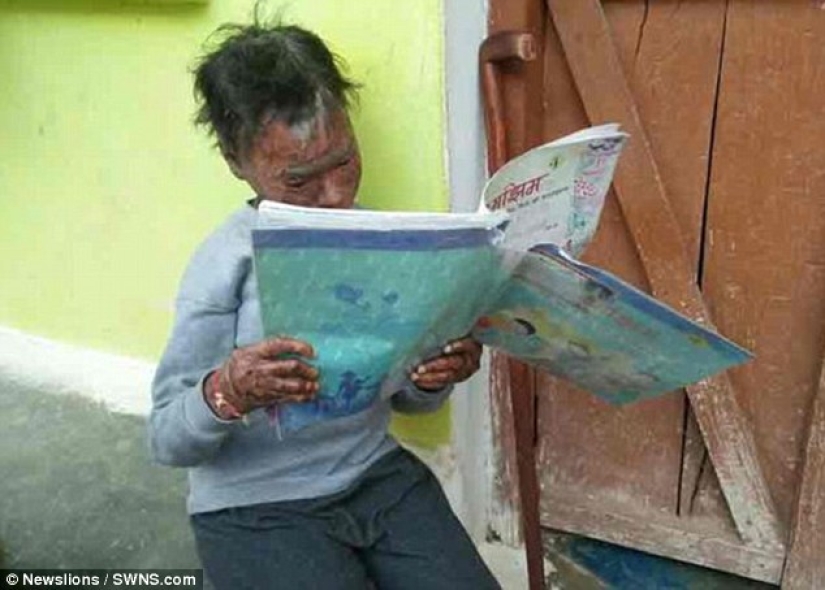 The snake girl sheds her skin every six weeks