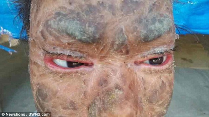 The snake girl sheds her skin every six weeks