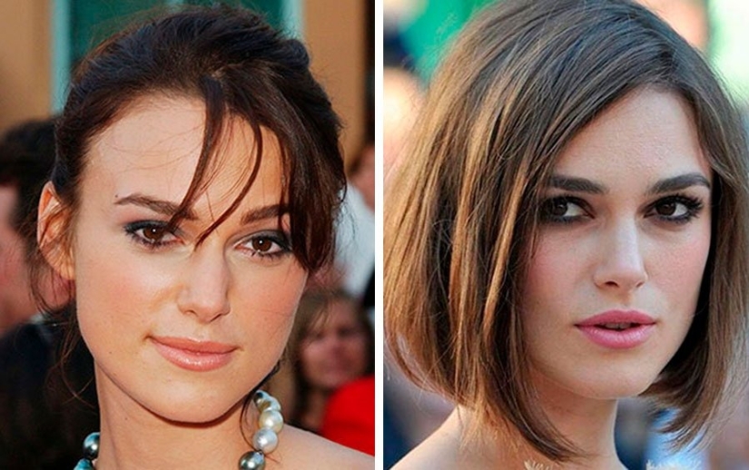 The surgeon did a great job: 10 stars with perfect facial plastic surgery