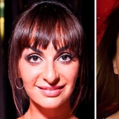 The surgeon did a great job: 10 stars with perfect facial plastic surgery