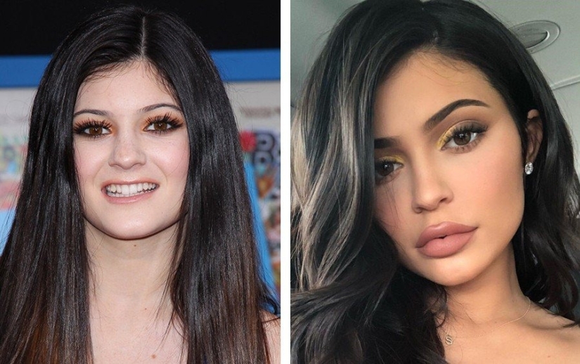 The surgeon did a great job: 10 stars with perfect facial plastic surgery
