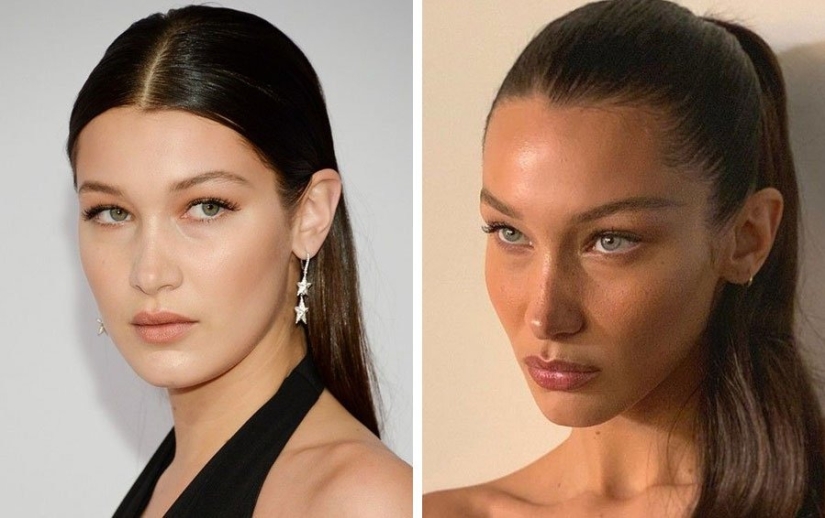 The surgeon did a great job: 10 stars with perfect facial plastic surgery