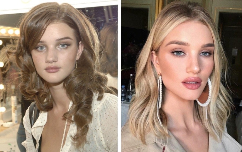 The surgeon did a great job: 10 stars with perfect facial plastic surgery