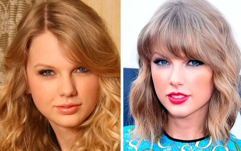 The surgeon did a great job: 10 stars with perfect facial plastic surgery