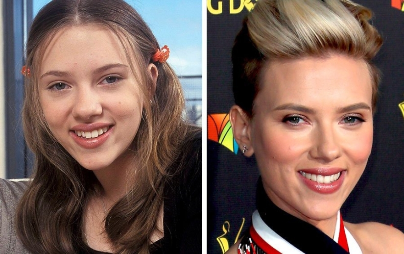 The surgeon did a great job: 10 stars with perfect facial plastic surgery