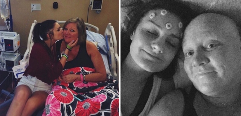 The teenager shaved his head in solidarity with his girlfriend with cancer