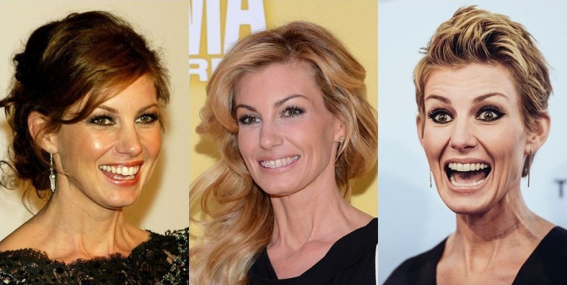 These celebrities will show you how braces can dramatically change your smile
