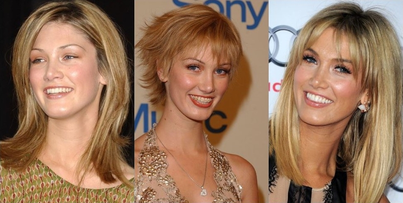 These celebrities will show you how braces can dramatically change your smile