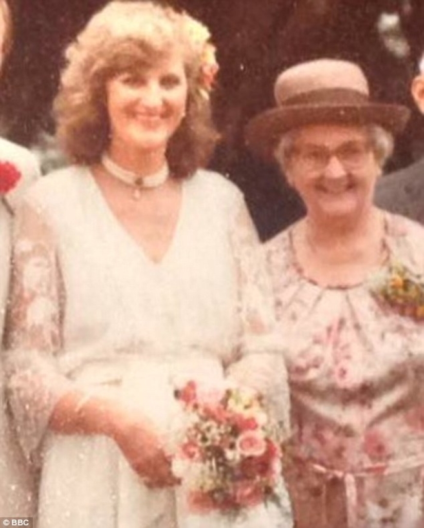 This woman's kidney recently celebrated its 100th anniversary