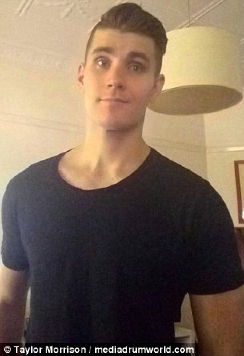 Todo es bueno con moderación: un hombre obeso perdió la mitad de su peso y se convirtió en Koshchei el Inmortal