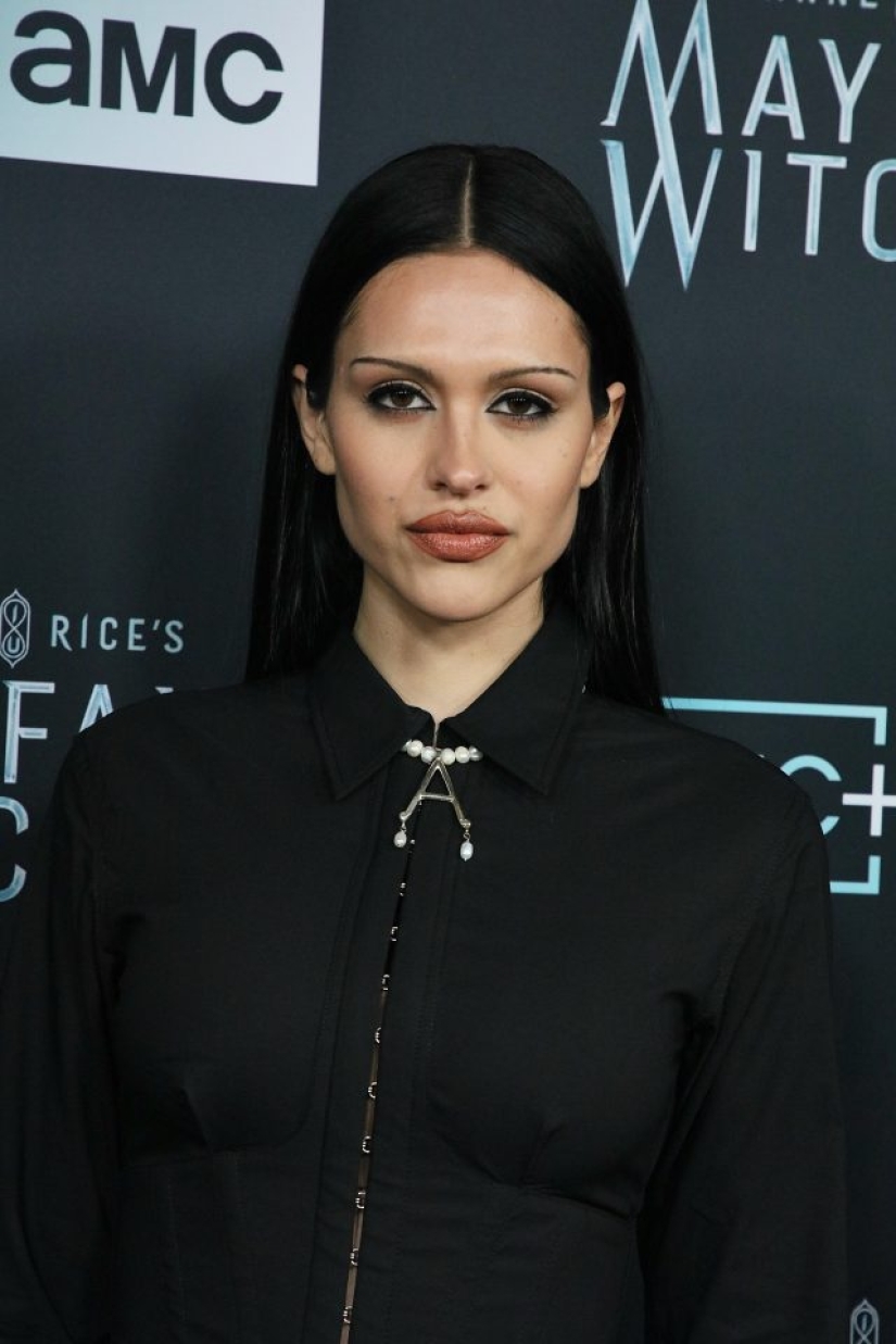 Todos quieren deshacerse de ellos: ¿por qué las estrellas de Hollywood están eliminando los bultos de Bish nuevamente y es necesario repetir después de ellos?