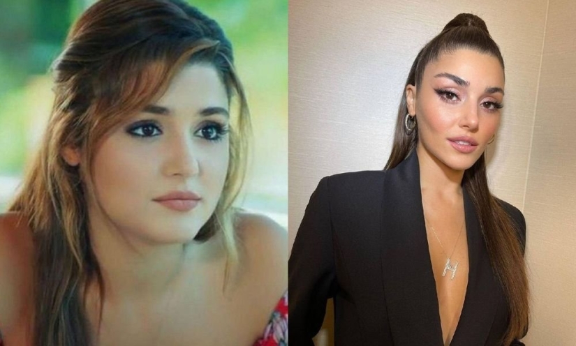¿Tuya o de plástico? Todas las cirugías plásticas de la belleza turca Hande Ercel