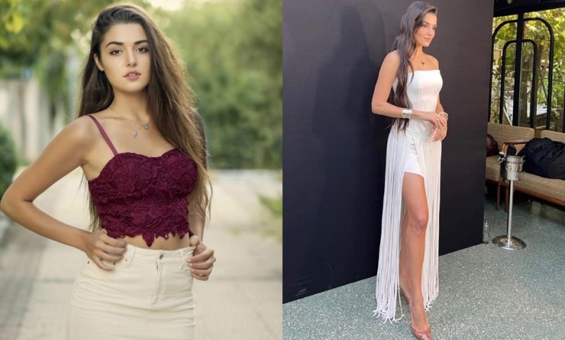 ¿Tuya o de plástico? Todas las cirugías plásticas de la belleza turca Hande Ercel