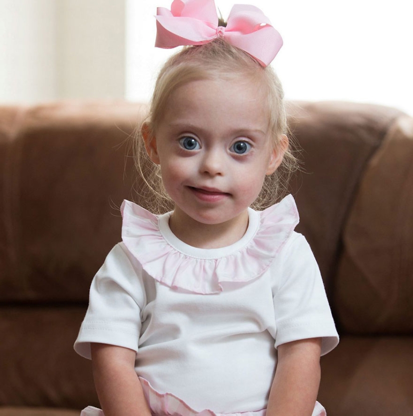 Two-year-old girl with Down syndrome became a model thanks to her radiant smile