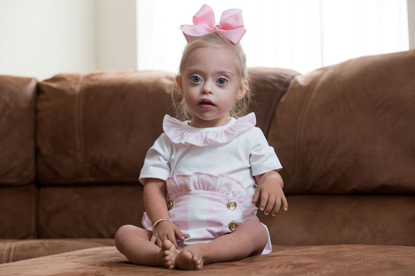 Two-year-old girl with Down syndrome became a model thanks to her radiant smile