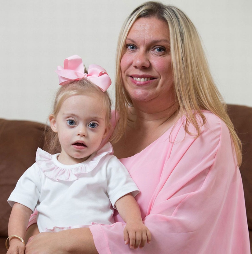 Two-year-old girl with Down syndrome became a model thanks to her radiant smile