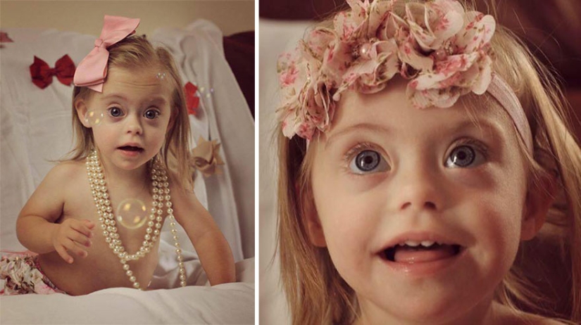 Two-year-old girl with Down syndrome became a model thanks to her radiant smile