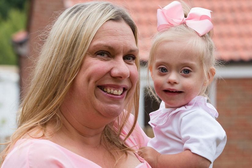 Two-year-old girl with Down syndrome became a model thanks to her radiant smile