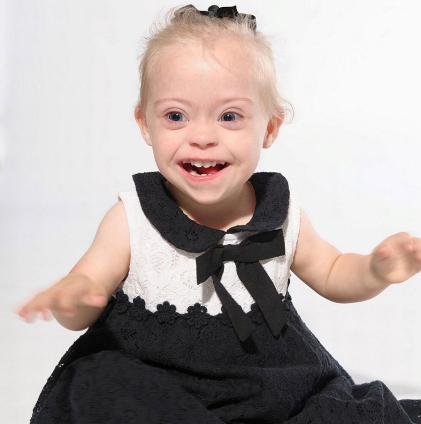 Two-year-old girl with Down syndrome became a model thanks to her radiant smile
