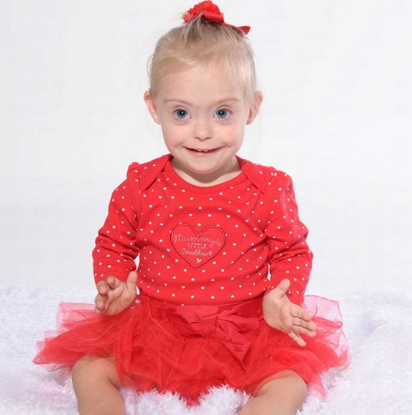 Two-year-old girl with Down syndrome became a model thanks to her radiant smile