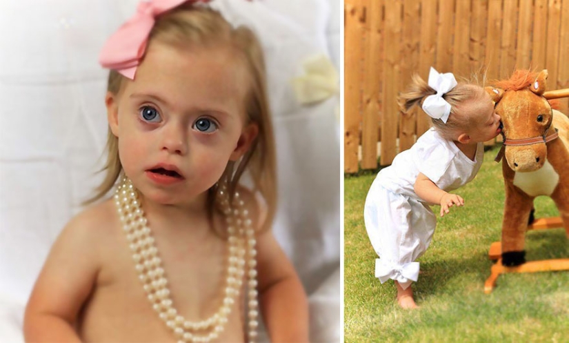 Two-year-old girl with Down syndrome became a model thanks to her radiant smile