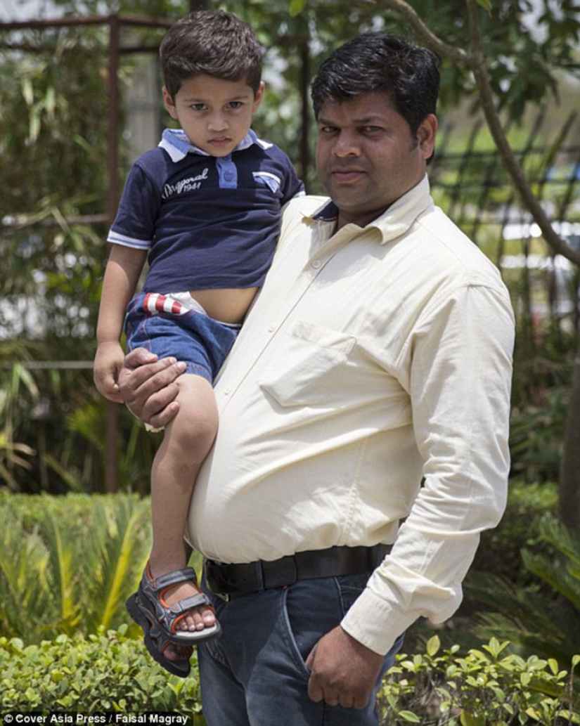 Un bebé de dos años de la India sufre pubertad prematura Un bebé de dos años de la India sufre pubertad prematura