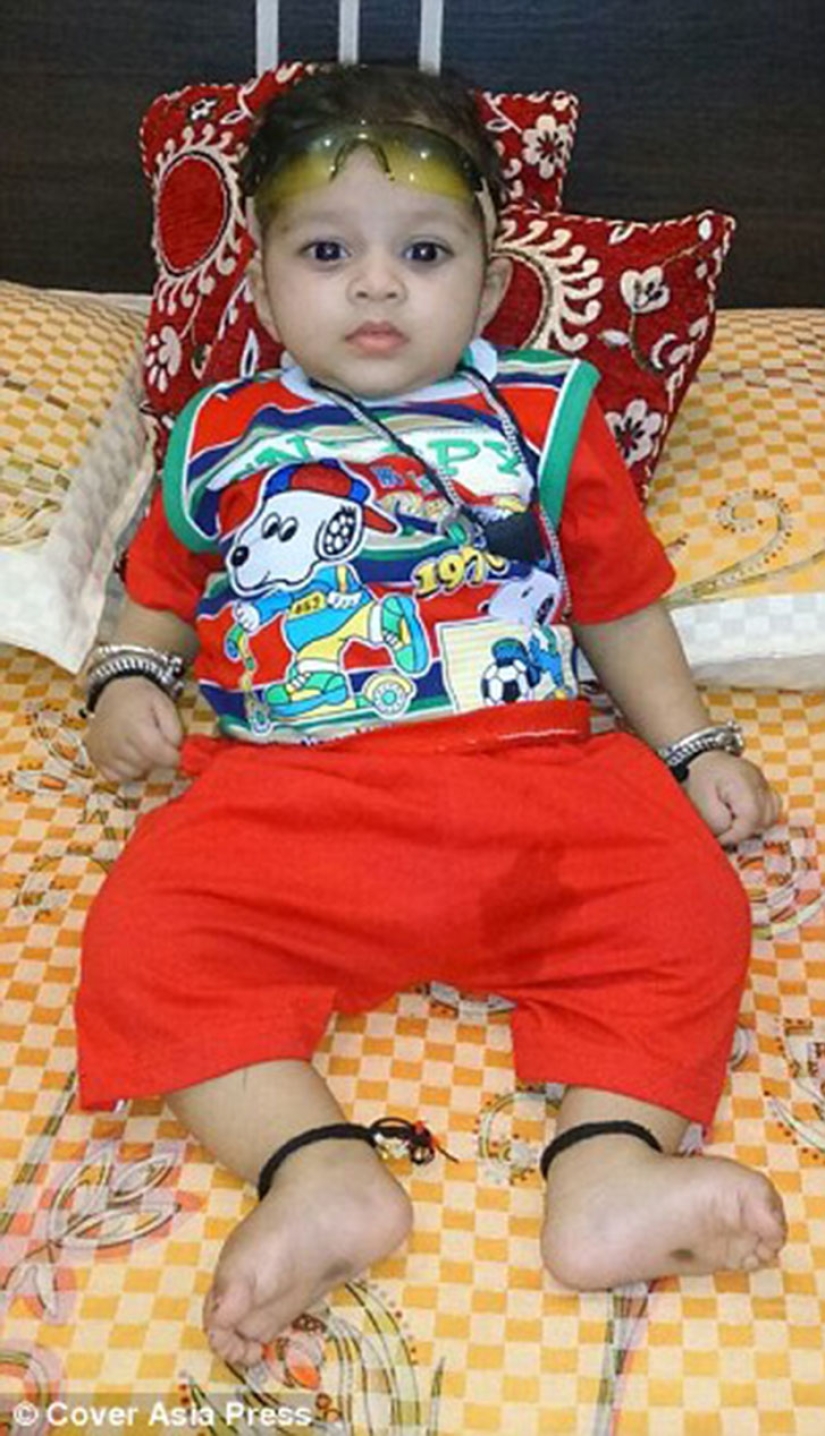 Un bebé de dos años de la India sufre pubertad prematura Un bebé de dos años de la India sufre pubertad prematura