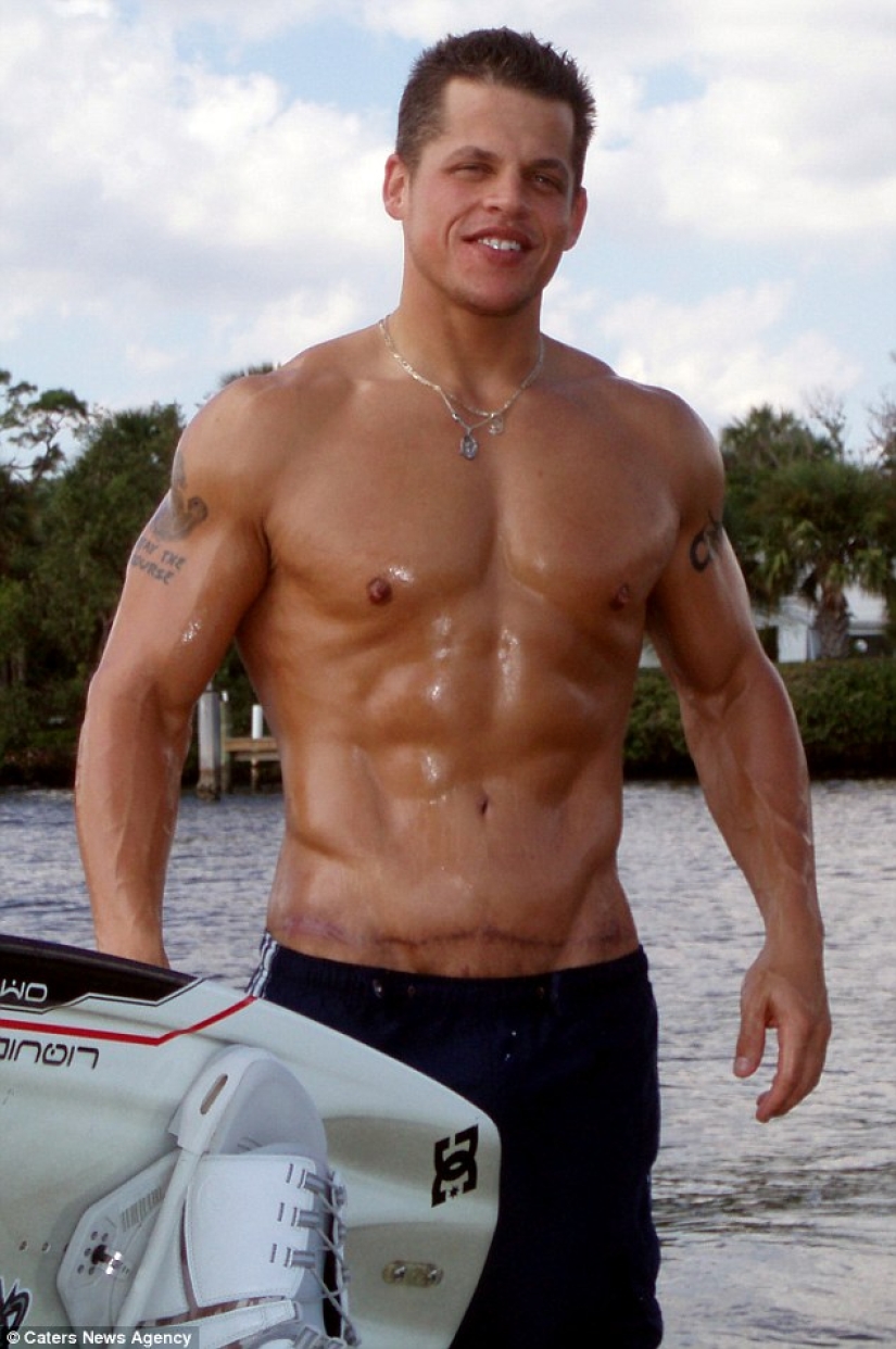 Un enorme estadounidense bajó 90 kg después de que lo obligaron a comprar dos asientos en un avión