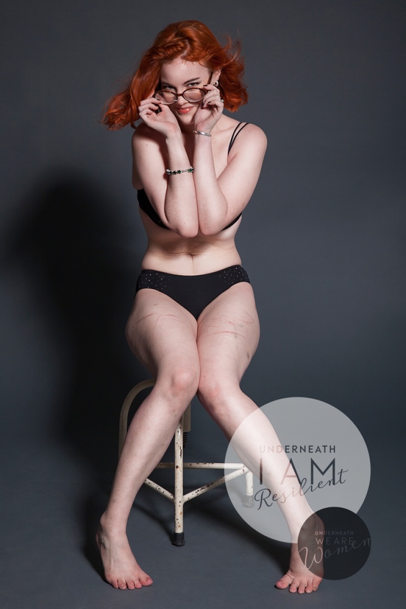 Un fotógrafo australiano ha fotografiado a 100 mujeres comunes en lencería como parte de un proyecto fotográfico positivo para el cuerpo Un fotógrafo australiano ha fotografiado a 100 mujeres comunes en lencería como parte de un proyecto fotográfico positivo para el cuerpo