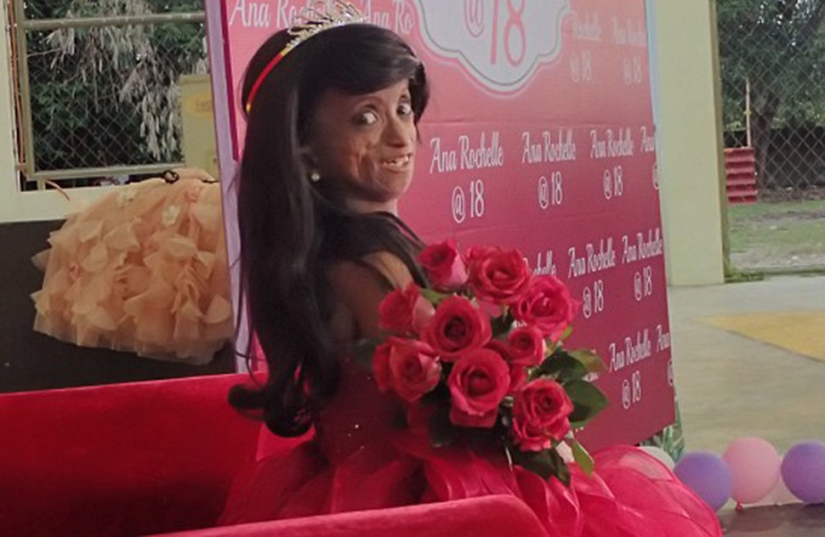 Una niña con el cuerpo de una mujer de 150 años murió en Filipinas Una niña con el cuerpo de una mujer de 150 años murió en Filipinas