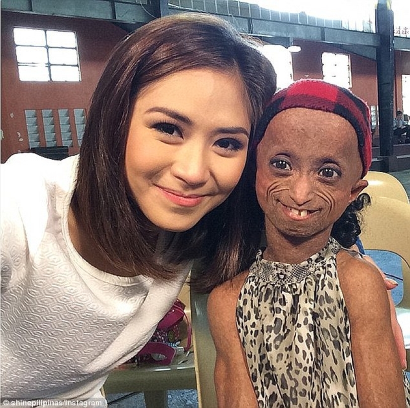 Una niña con el cuerpo de una mujer de 150 años murió en Filipinas Una niña con el cuerpo de una mujer de 150 años murió en Filipinas