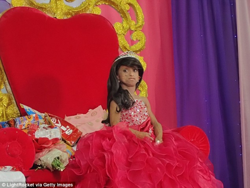 Una niña con el cuerpo de una mujer de 150 años murió en Filipinas Una niña con el cuerpo de una mujer de 150 años murió en Filipinas