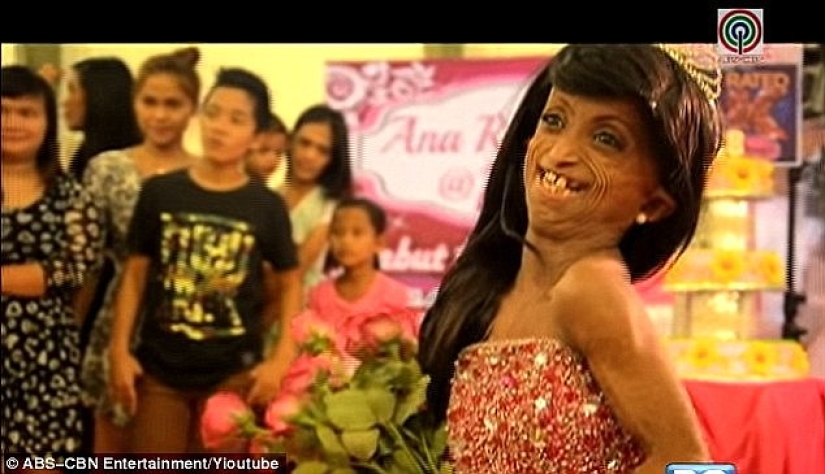 Una niña con el cuerpo de una mujer de 150 años murió en Filipinas Una niña con el cuerpo de una mujer de 150 años murió en Filipinas