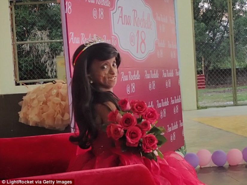 Una niña con el cuerpo de una mujer de 150 años murió en Filipinas Una niña con el cuerpo de una mujer de 150 años murió en Filipinas