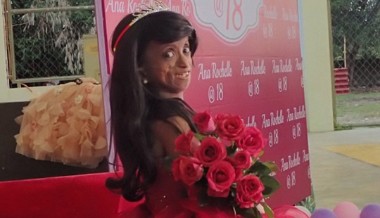 Una niña con el cuerpo de una mujer de 150 años murió en Filipinas