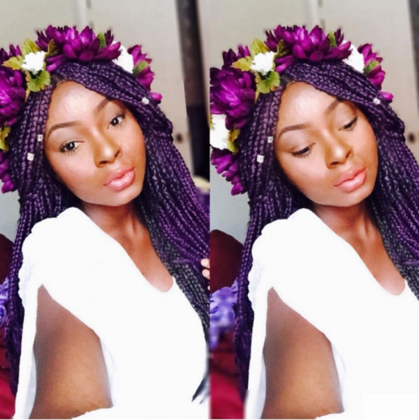 Una niña con graves quemaduras faciales demuestra el poder del maquillaje Una niña con graves quemaduras faciales demuestra el poder del maquillaje