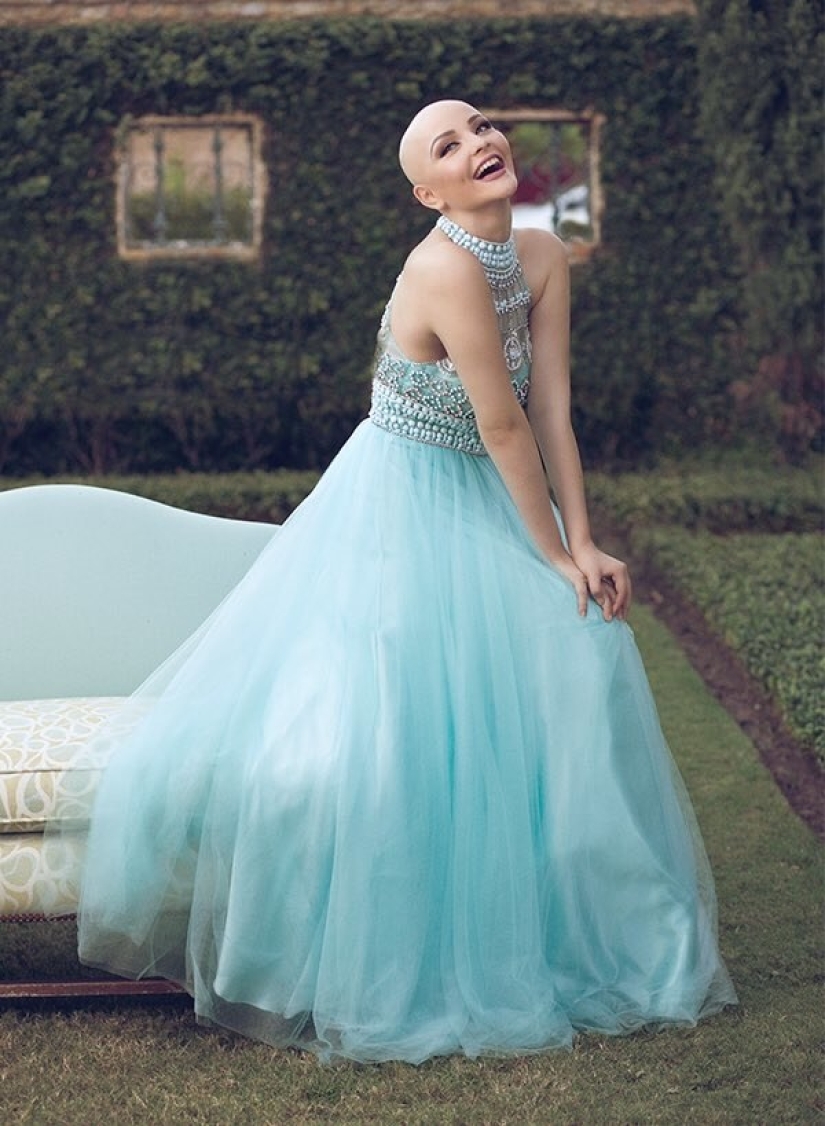 Una niña de 17 años que lucha contra el cáncer protagonizó una atrevida sesión de fotos sin peluca