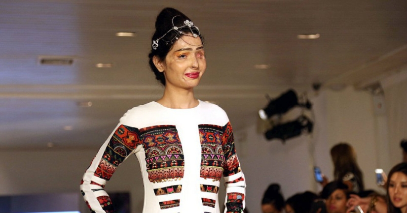 Víctima de fumigación ácida caminó por la pasarela en la Semana de la Moda de Nueva York
