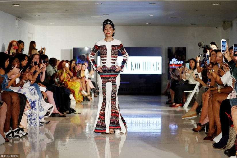 Víctima de fumigación ácida caminó por la pasarela en la Semana de la Moda de Nueva York