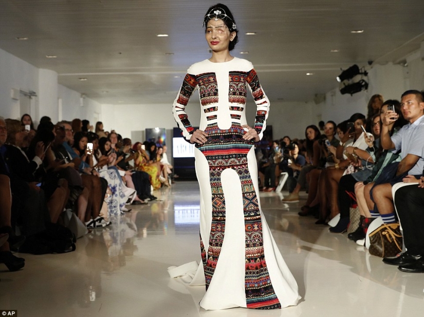 Víctima de fumigación ácida caminó por la pasarela en la Semana de la Moda de Nueva York