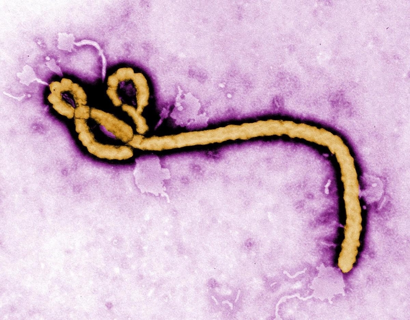 Virus del ébola: el mundo está en fiebre Virus del ébola: el mundo está en fiebre