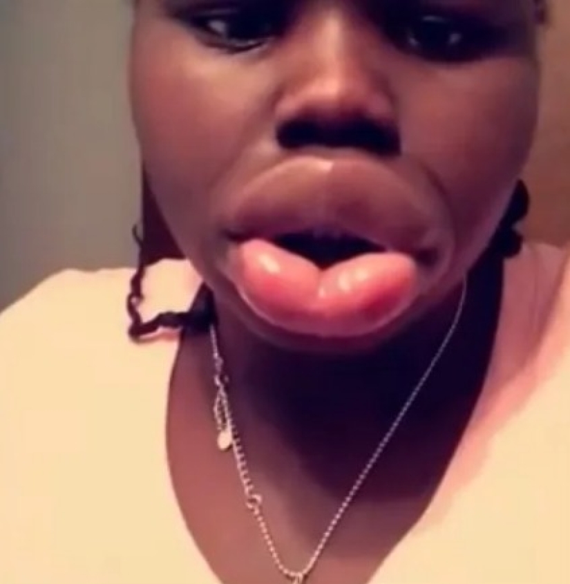 Why do black people have such big lips? I explain simply