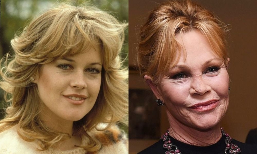 With age, their beauty came to naught: 10 transformations of stars