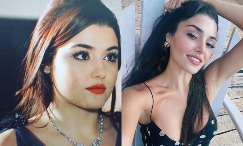 Yours or plastic? All plastic surgeries of Turkish beauty Hande Ercel